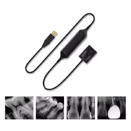 dental x ray sensor 2 dental x ray sensor 2