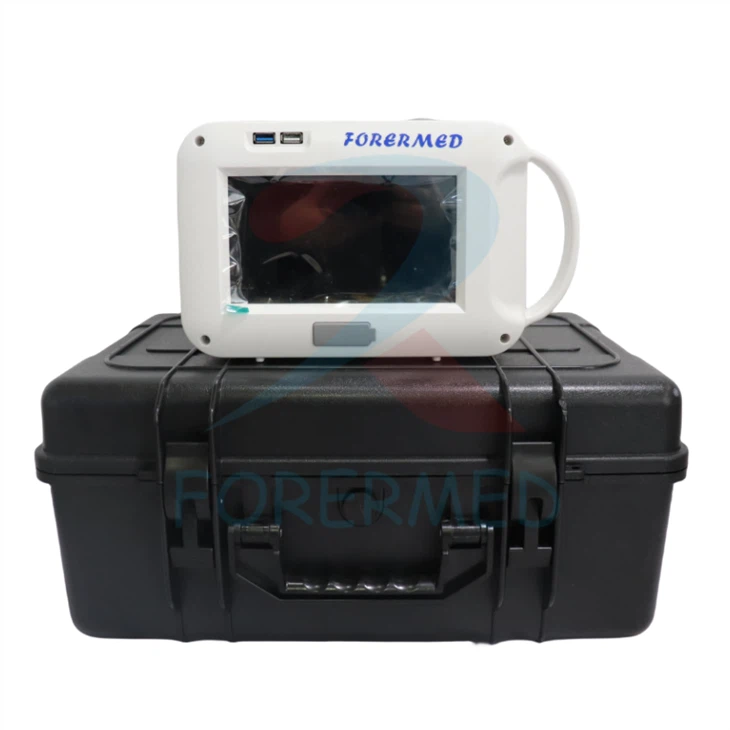 Handheld X Ray Machine Handheld X Ray Machine
