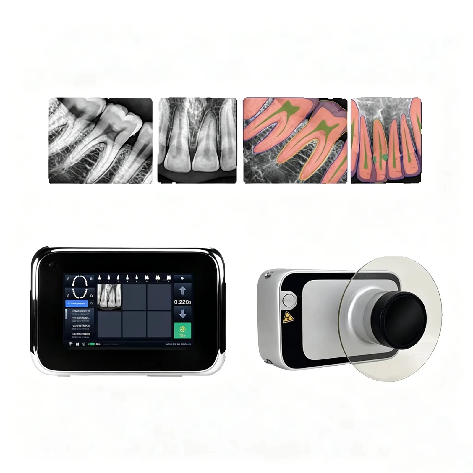 Dental Sensor Dental Sensor