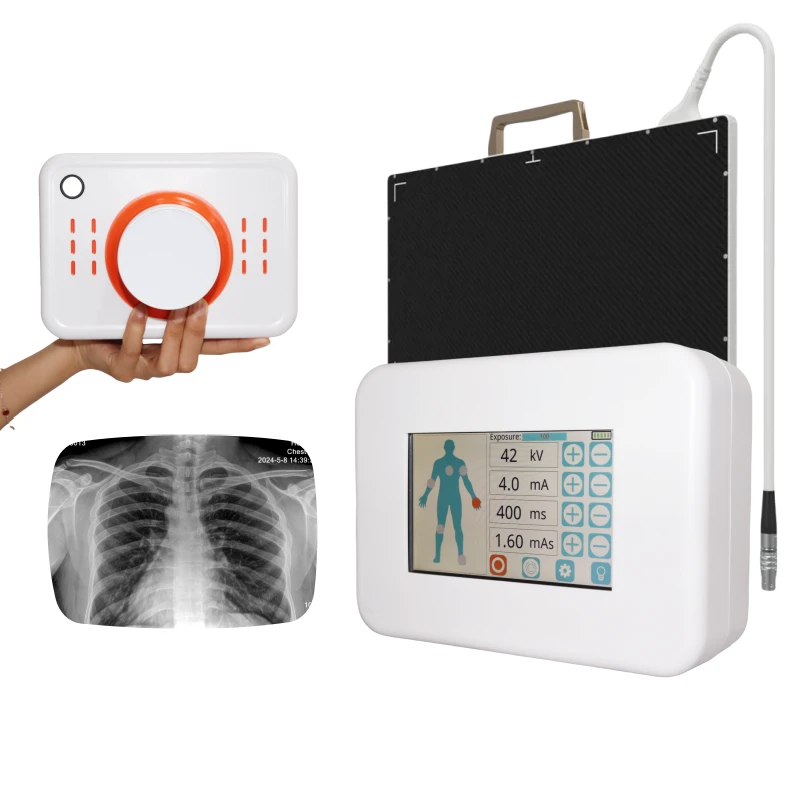 PORTABLE X RAY MACHINE PORTABLE X RAY MACHINE