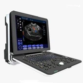 ল্যাপটপ অতিস্বনক ডায়াগনস্টিক সিস্টেম