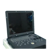 সোনোগ্রাম আল্ট্রাসাউন্ড