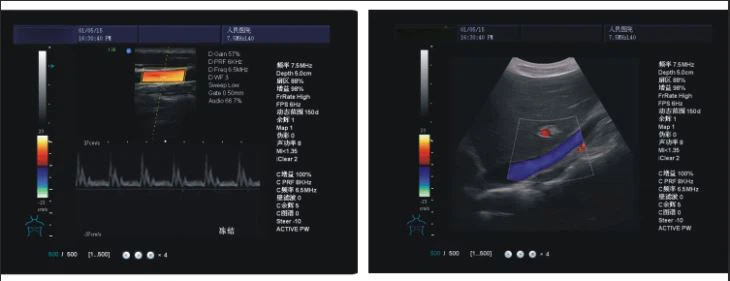 4D Color Doppler Ultrasound Scanner 4D Color Doppler Ultrasound Scanner